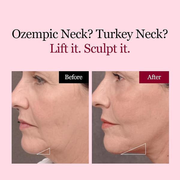 Collagen V-Lift Gel Mask