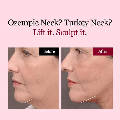 Unleash Your Radiance, Embrace a Sculpted You