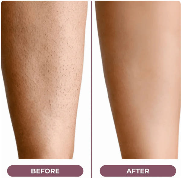Lavocs™ 2‑in‑1 Shaver